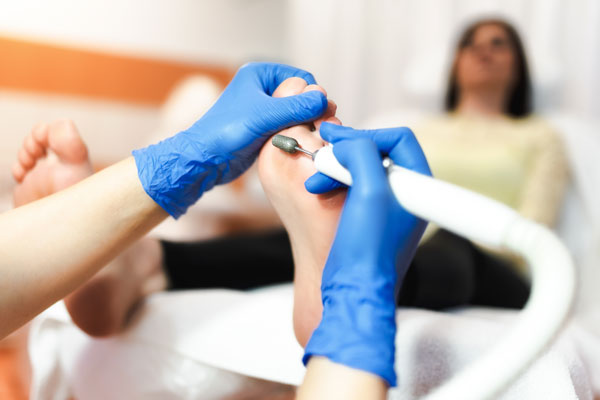 Medische pedicure behandeling Haarlem Medische pedicure in Haarlem behandelt voeten professioneel